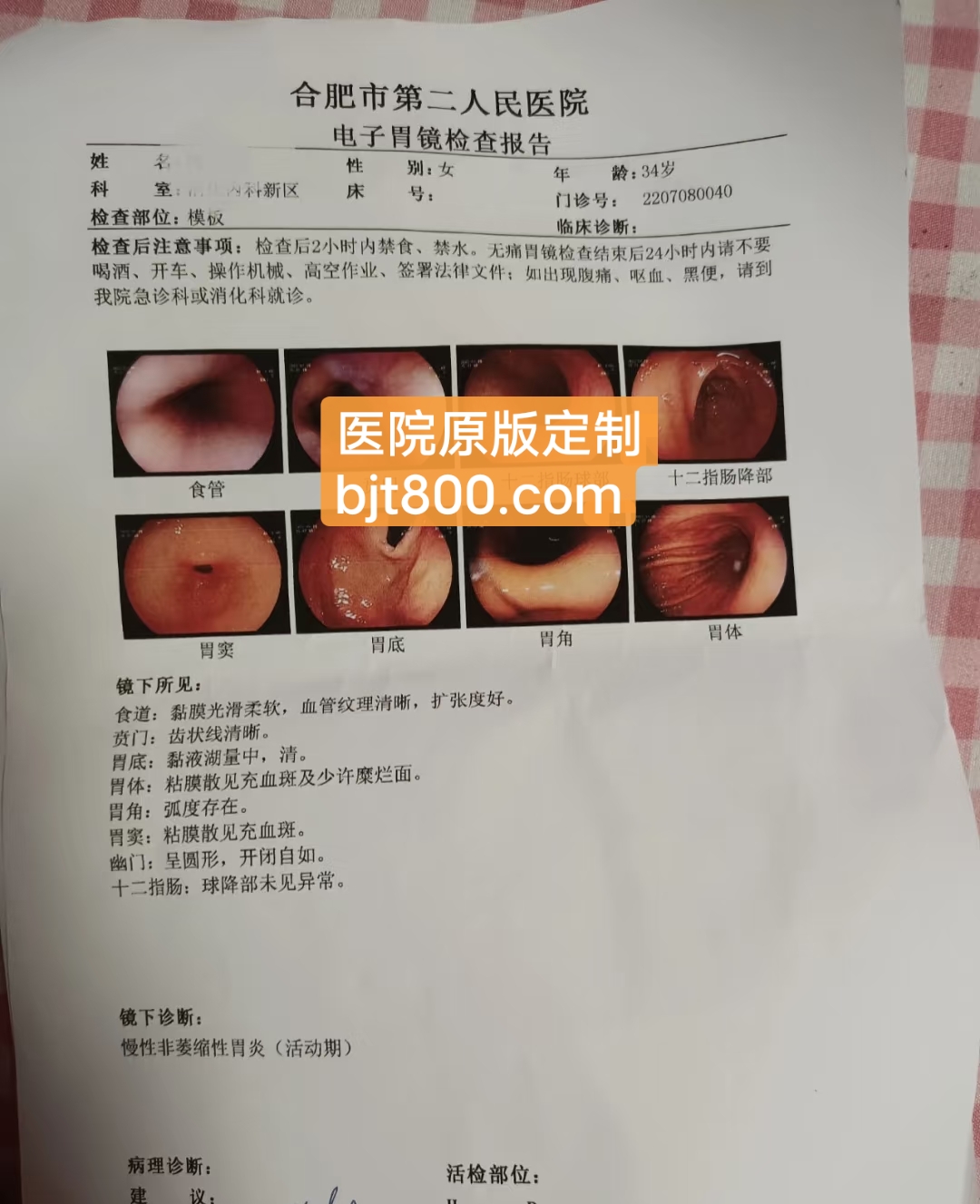 合肥市第二人民医院胃镜报告单
