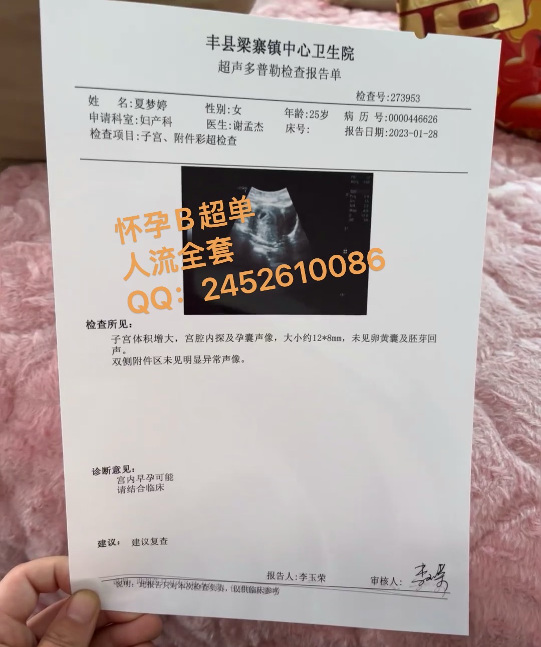 怀孕B超单/怀孕B超图片/早孕B超样本