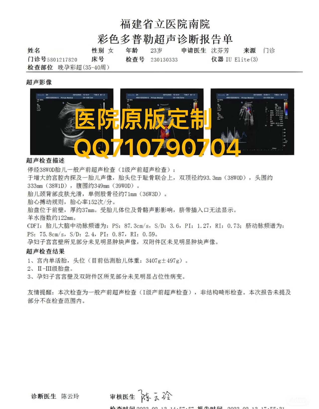 怀孕证明/怀孕B超单样本