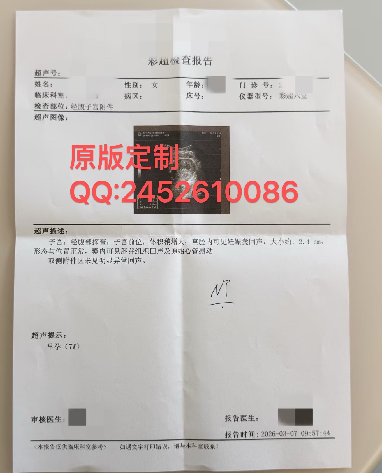怀孕早孕B超报告图片/人流手术证明