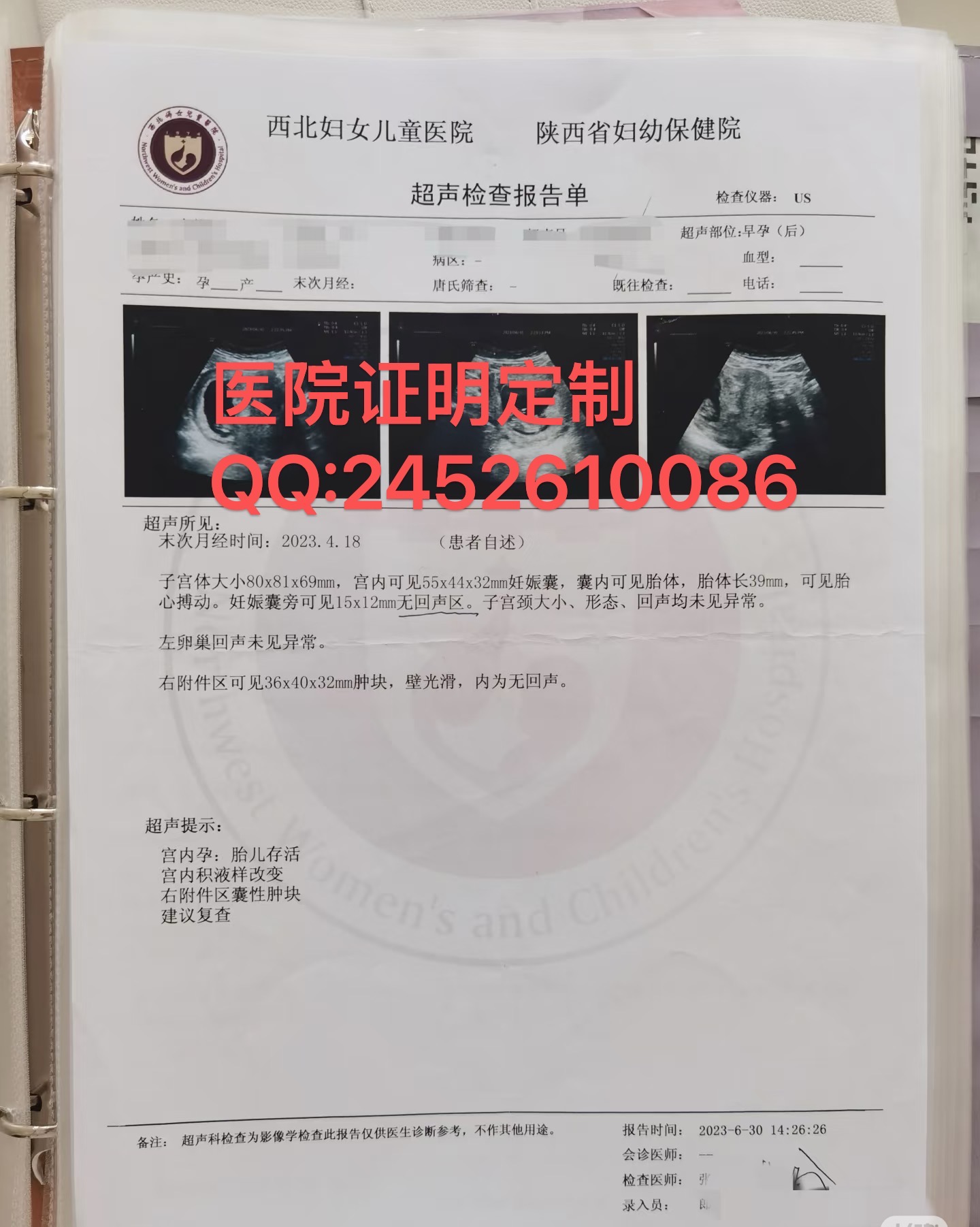 怀孕4周B超报告单/妊娠早期孕B超图片